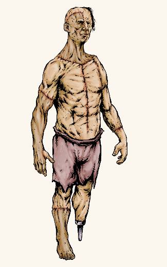 Flesh Golem